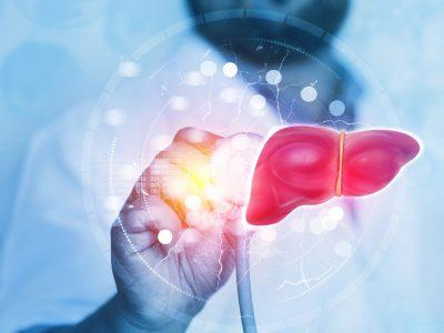 ۵ نشانه روی صورت که فریاد میزند کبدتان چرب است