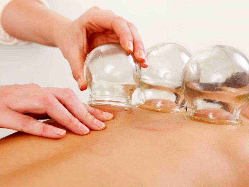 هشدار وزارت بهداشت درباره انجام خودسرانه حجامت/ ضرورت تجویز پزشکان و متخصص طب ایرانی