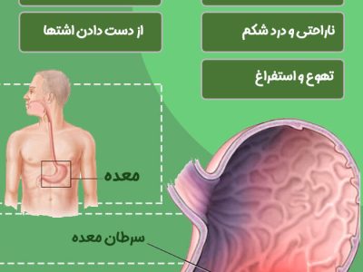 طراحی سامانه هوشمند تشخیص زودهنگام سرطان معده در دانشگاه علوم پزشکی تبریز