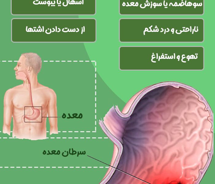 طراحی سامانه هوشمند تشخیص زودهنگام سرطان معده در دانشگاه علوم پزشکی تبریز